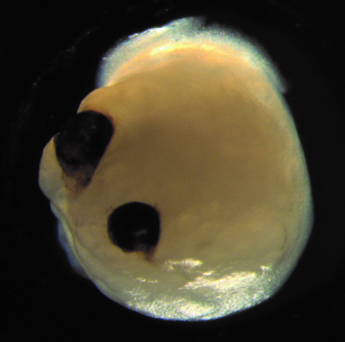 Mini Brains Grown From Stem Cells Developed Light-Sensitive, Eye-Like Features | Smart News - Vimarsana News