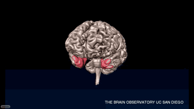 A Postmortem of the Most Famous Brain in Neuroscience History
