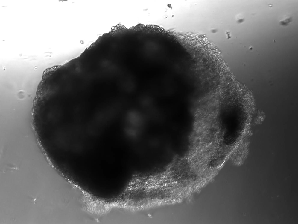 An animated image of a damaged cardioid is dark on one side, which is pulsing, and light on the other side, where the cells are dead