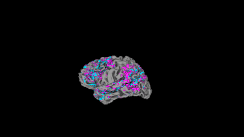 A spinning 3D view of one person&#39;s cerebral cortex. Pink indicates above average activity and blue shows below average activity.