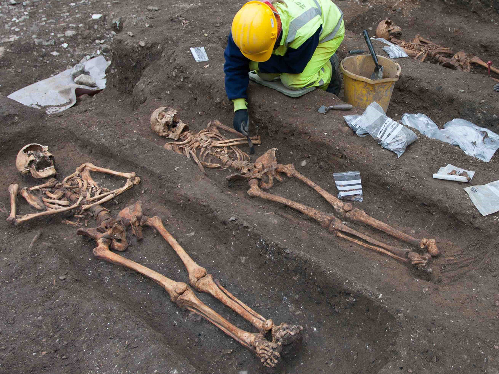 Why Were Medieval Monks So Susceptible to Intestinal Worms? | Science - Vimarsana News