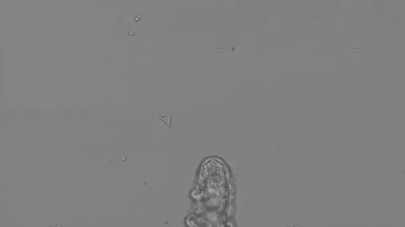 Animated Image: An underside view of a tardigrade trotting along