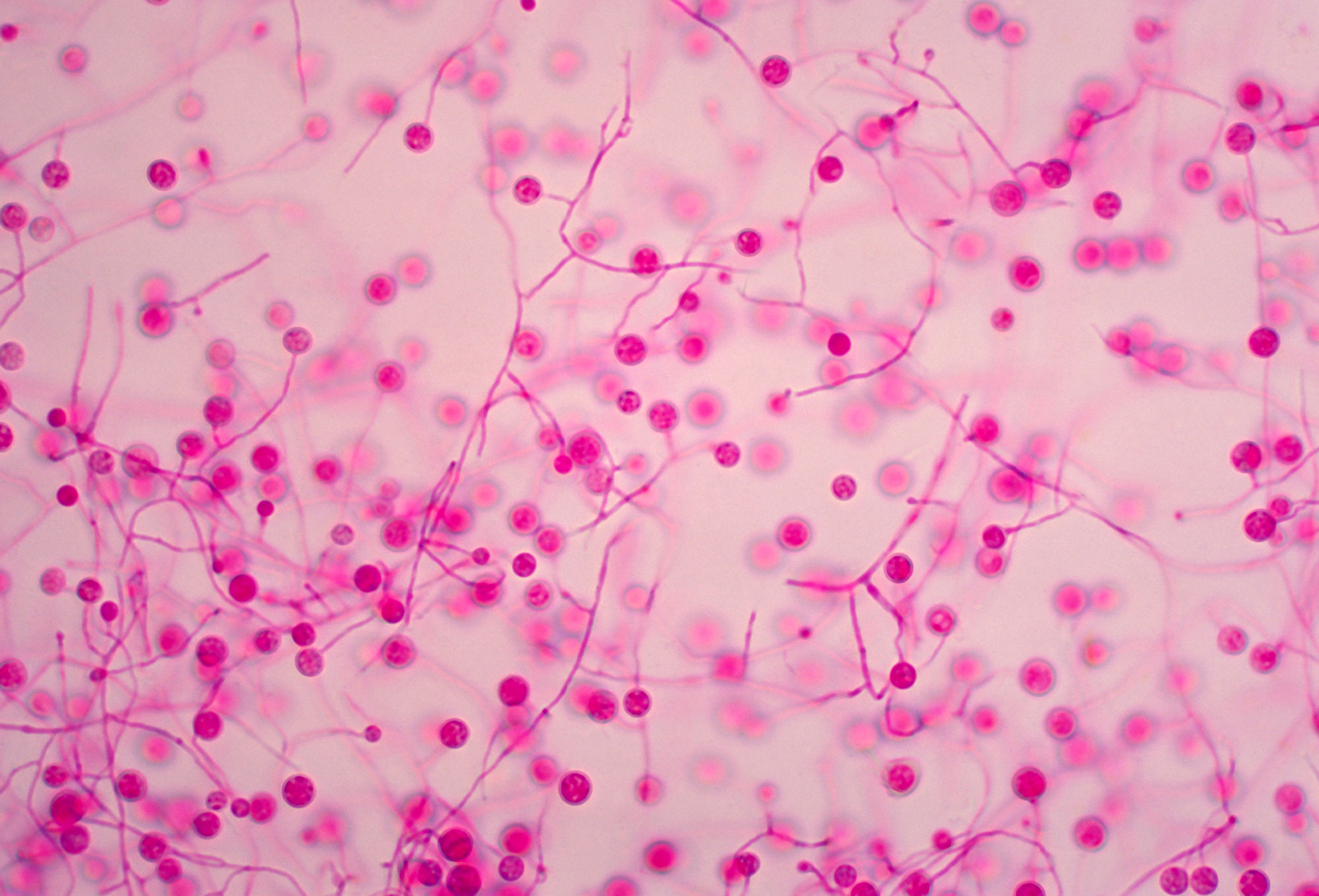 Fungi That Cause Lung Infections May Be Spreading Across the U.S. | Smart News - Vimarsana News