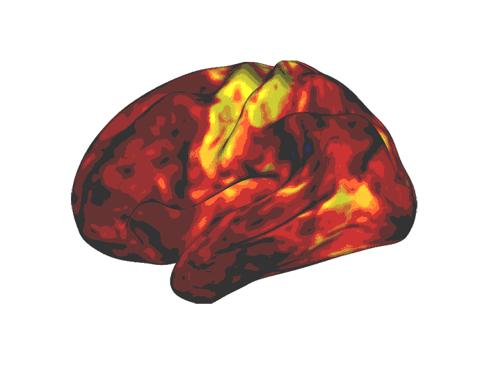 Stimulants prescribed for ADHD target the parts of the brain related to wakefulness and reward, shown in yellow and orange, according to a new study.