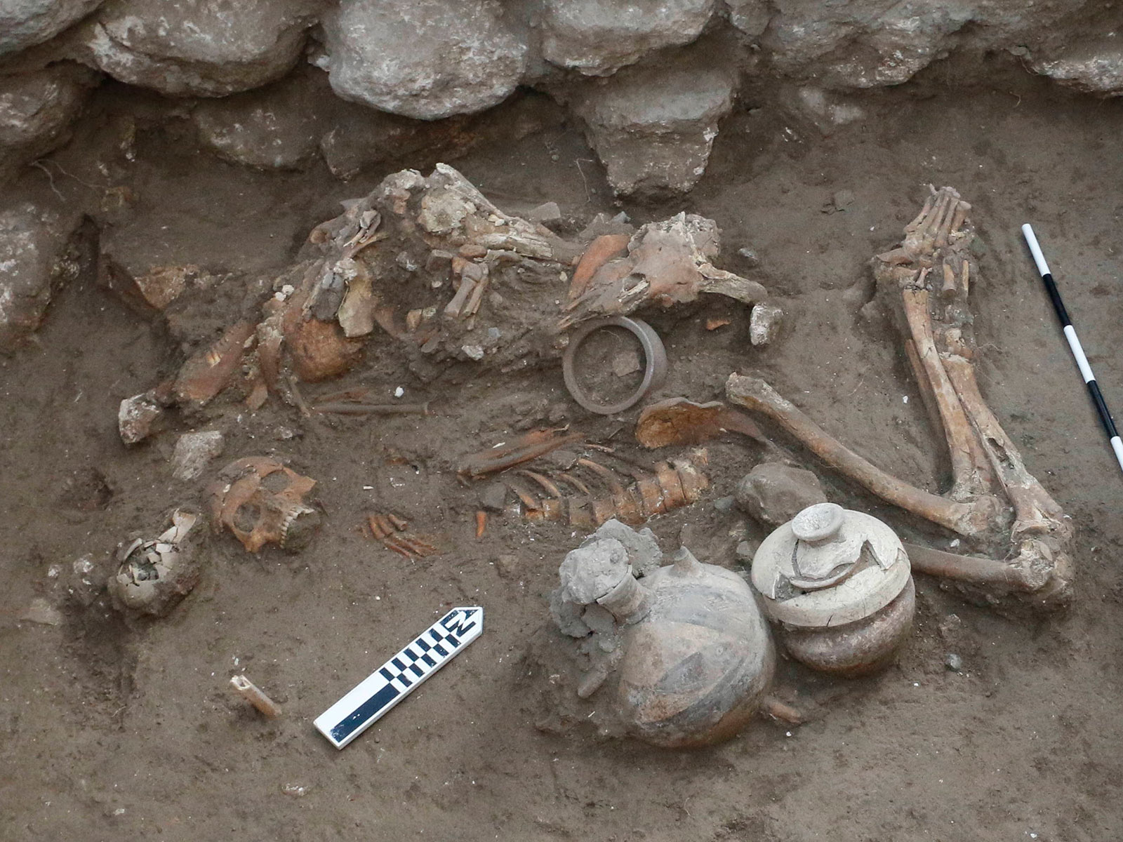 This Man Underwent Brain Surgery 3,500 Years Ago | Science - Vimarsana News