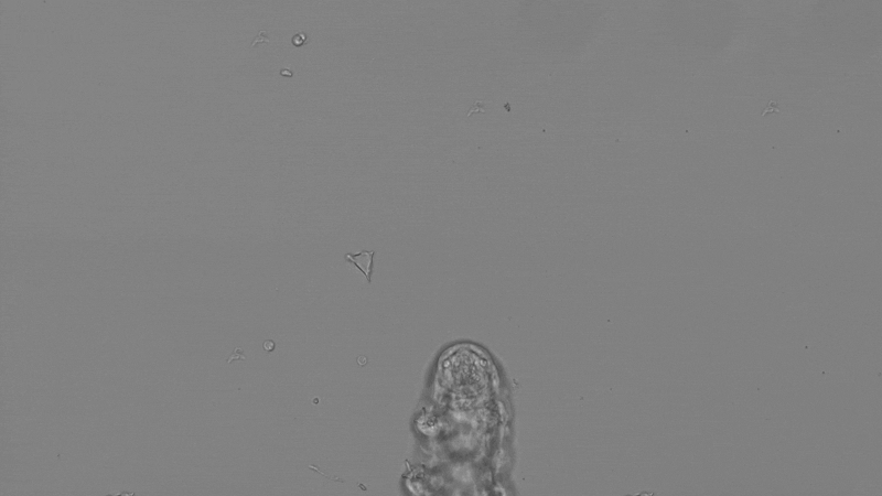 GIF Image: An underside view of a tardigrade trotting along