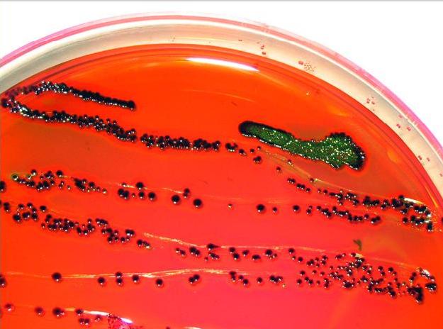 Scientists Turn E. Coli Into 'Living Ink' for 3-D Printing | Smart News - Vimarsana News