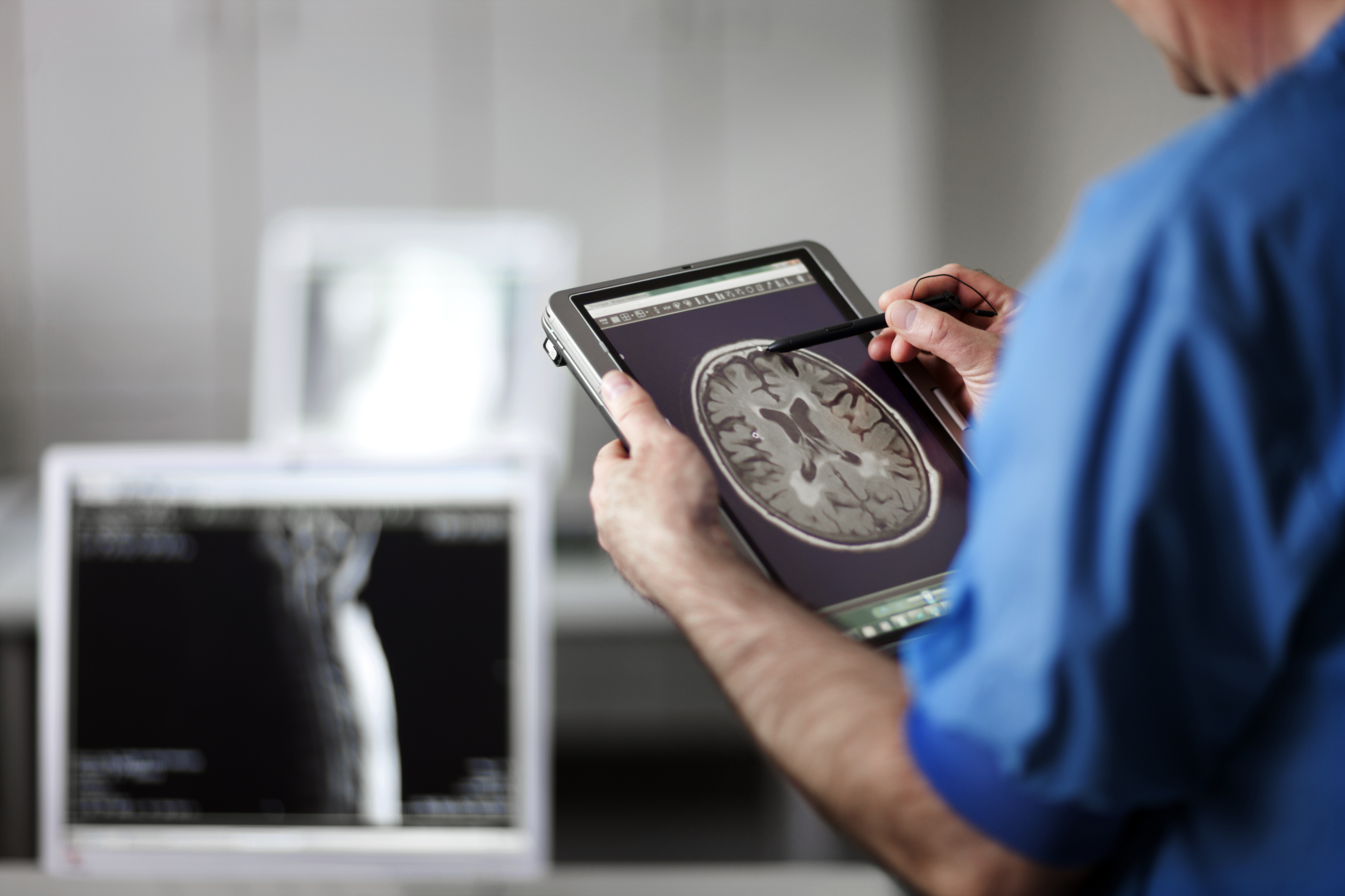 Even Mild Covid-19 Infections May Change the Brain, New Study Finds | Smart News - Vimarsana News