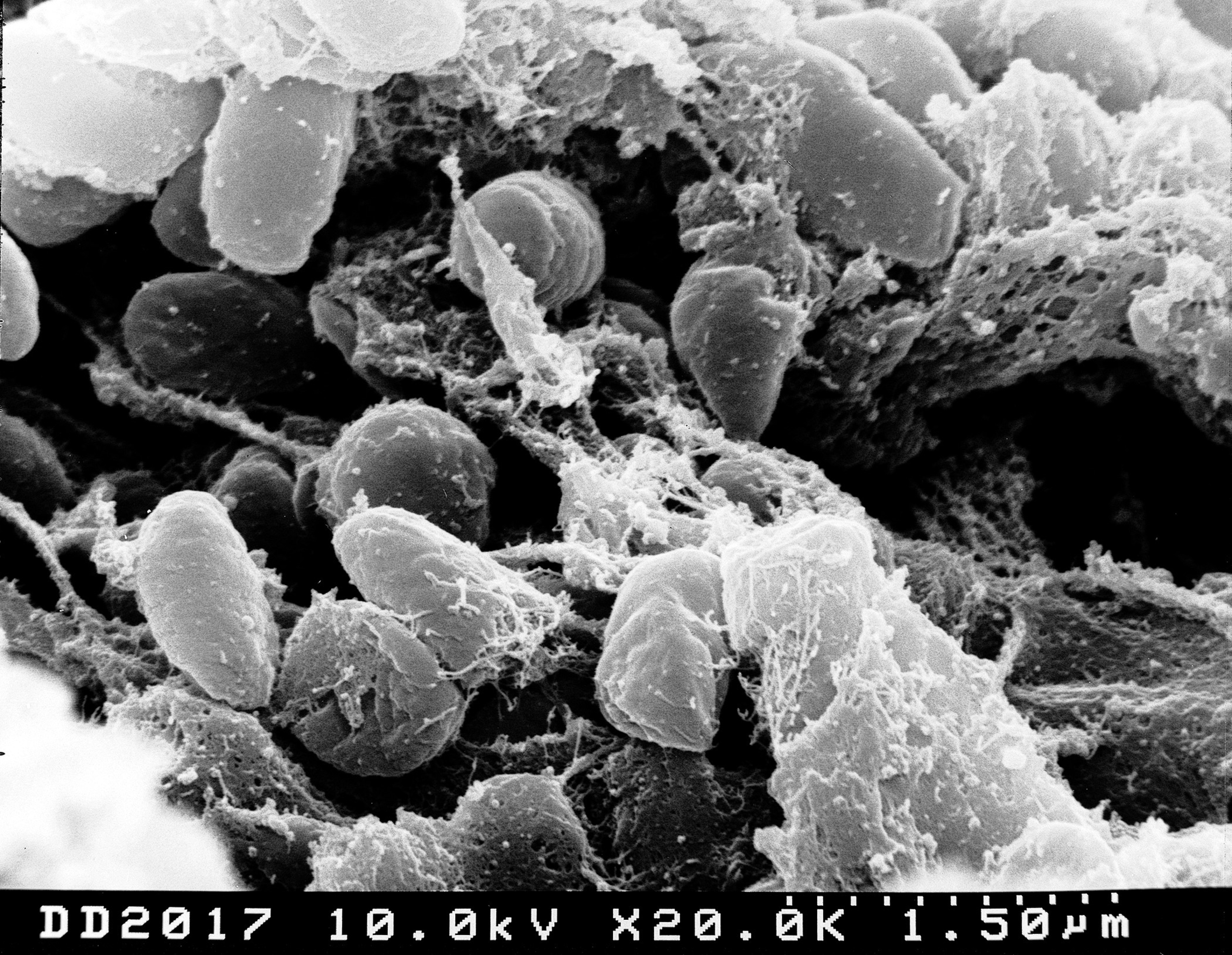 Medieval Skeletons Reveal How the Bubonic Plague Influenced Human DNA | Smart News - Vimarsana News