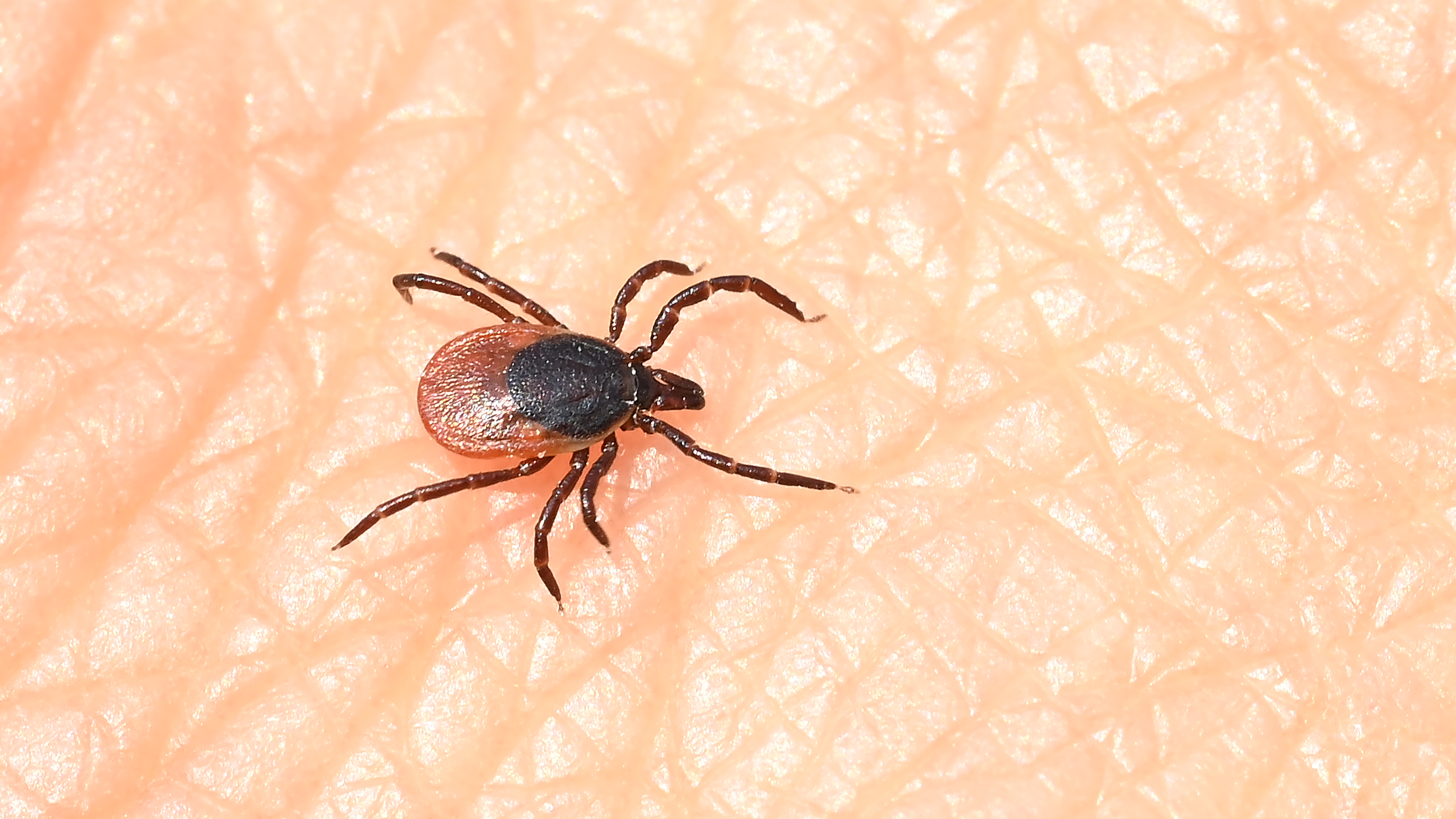 Large Lyme Disease Vaccine Clinical Trial Begins in U.S. and Europe | Smart News - Vimarsana News