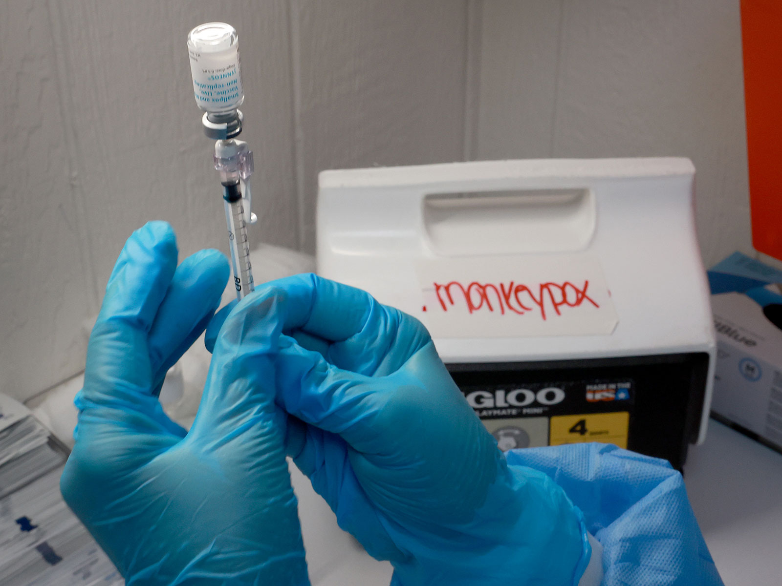 Six Big Questions About the Monkeypox Virus, Answered | Science - Vimarsana News